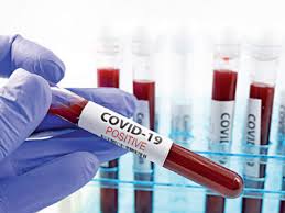 காங்கேசன்துறை கடற்படை முகாமில் கடற்படையினர் இருவருக்கு கொரோனா தொற்று